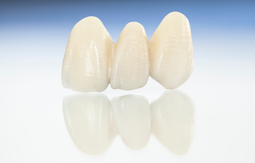 Ceramic teeth
